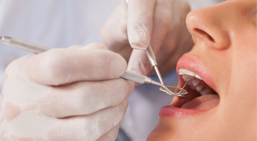 Kada reikalingas dantų kanalų gydymas?